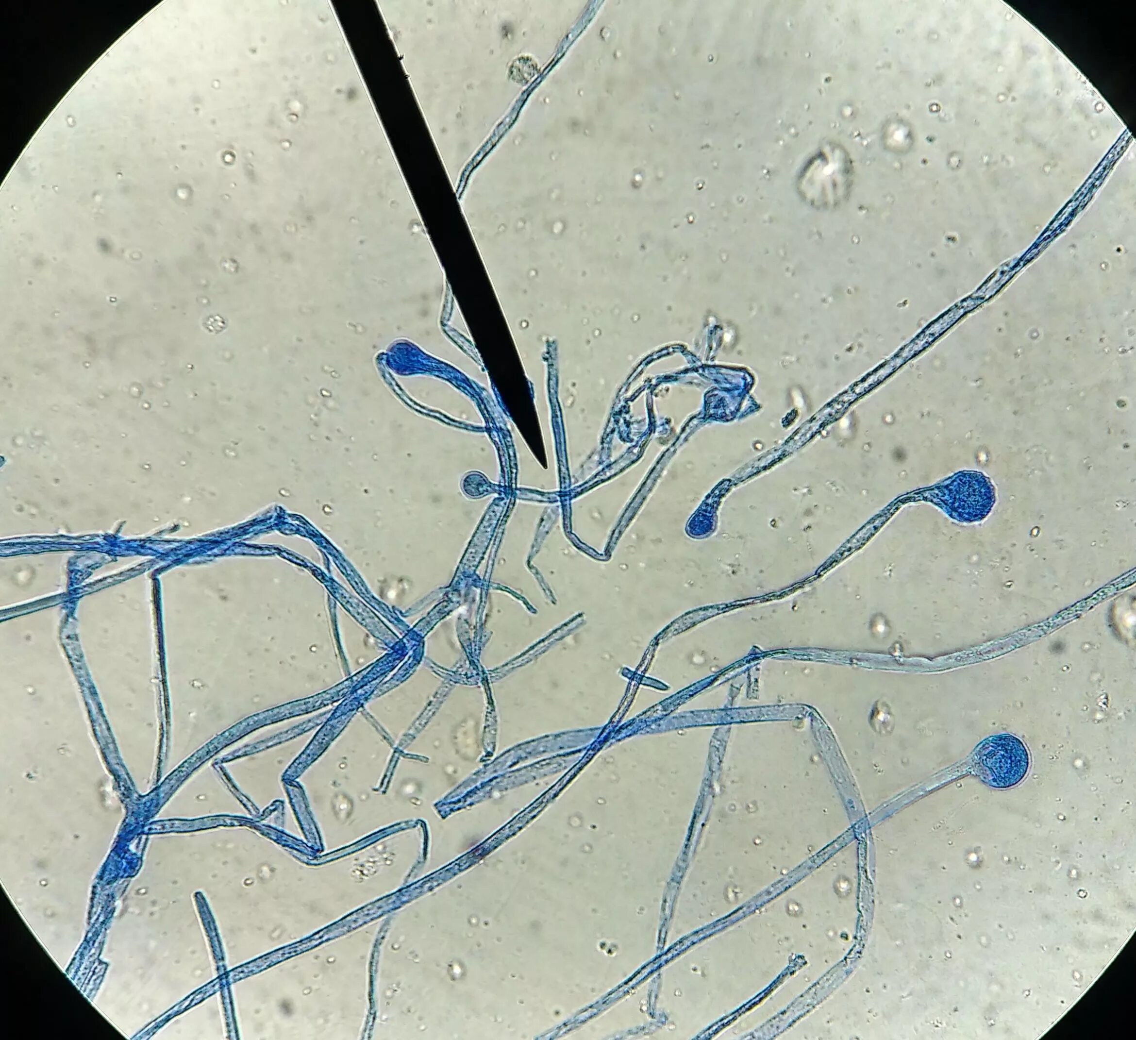 Микроскопия. Ризопус микроскопия. Rhizopus микробиология. Микроскопия Trichoderma. Зигомицеты микроскопия.