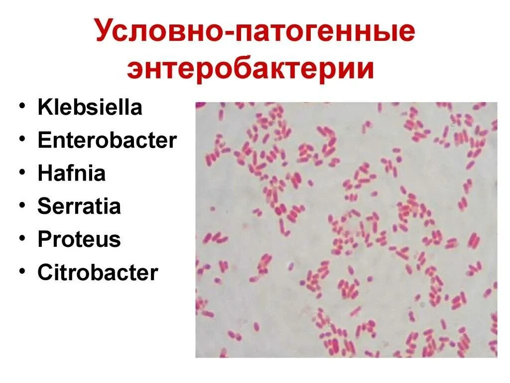 Грамположительные палочки. Энтеробактерии анаэробы. Энтеробактер аэрогенес. Энтеробактерии. 5.