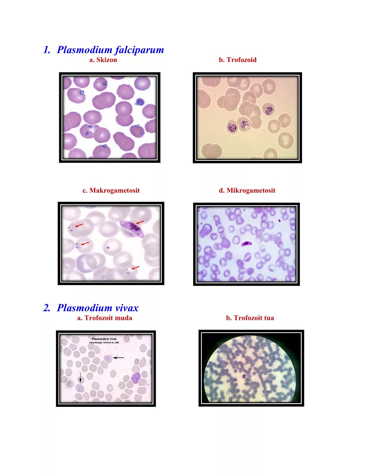 Стадии развития p falciparum обнаруживаемые при микроскопии. Plasmodium falciparum строение. малярия фальципарум. плазмодий вивакс. plasmodium falciparum трофозоит.