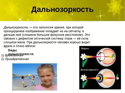 У ребенка зрение плюс