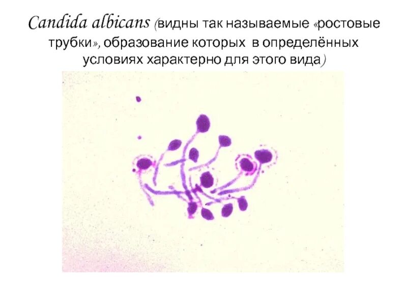 Споры candida. Candida albicans мицелий. Candida albicans микроскопия. Candida albicans по Граму. Candida albicans окраска по Граму.