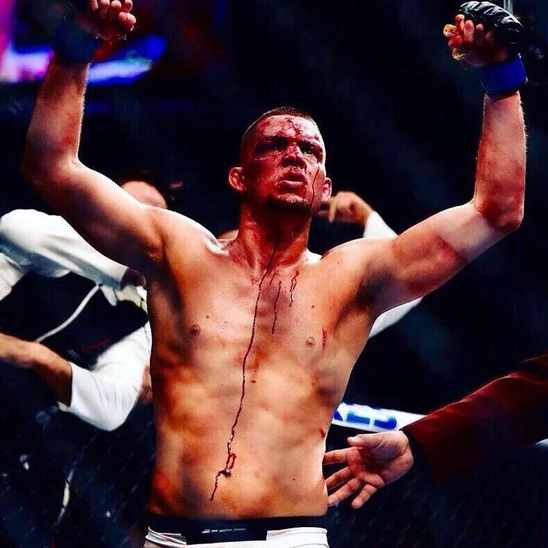 Conor McGregor leaves Nate Diaz pouring with blood after brutal decision victory