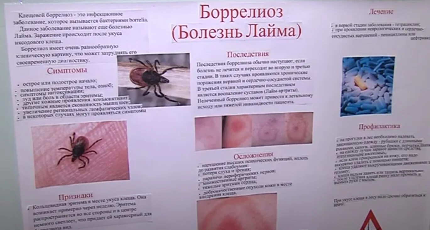Как уберечься от клещевого боррелиоза