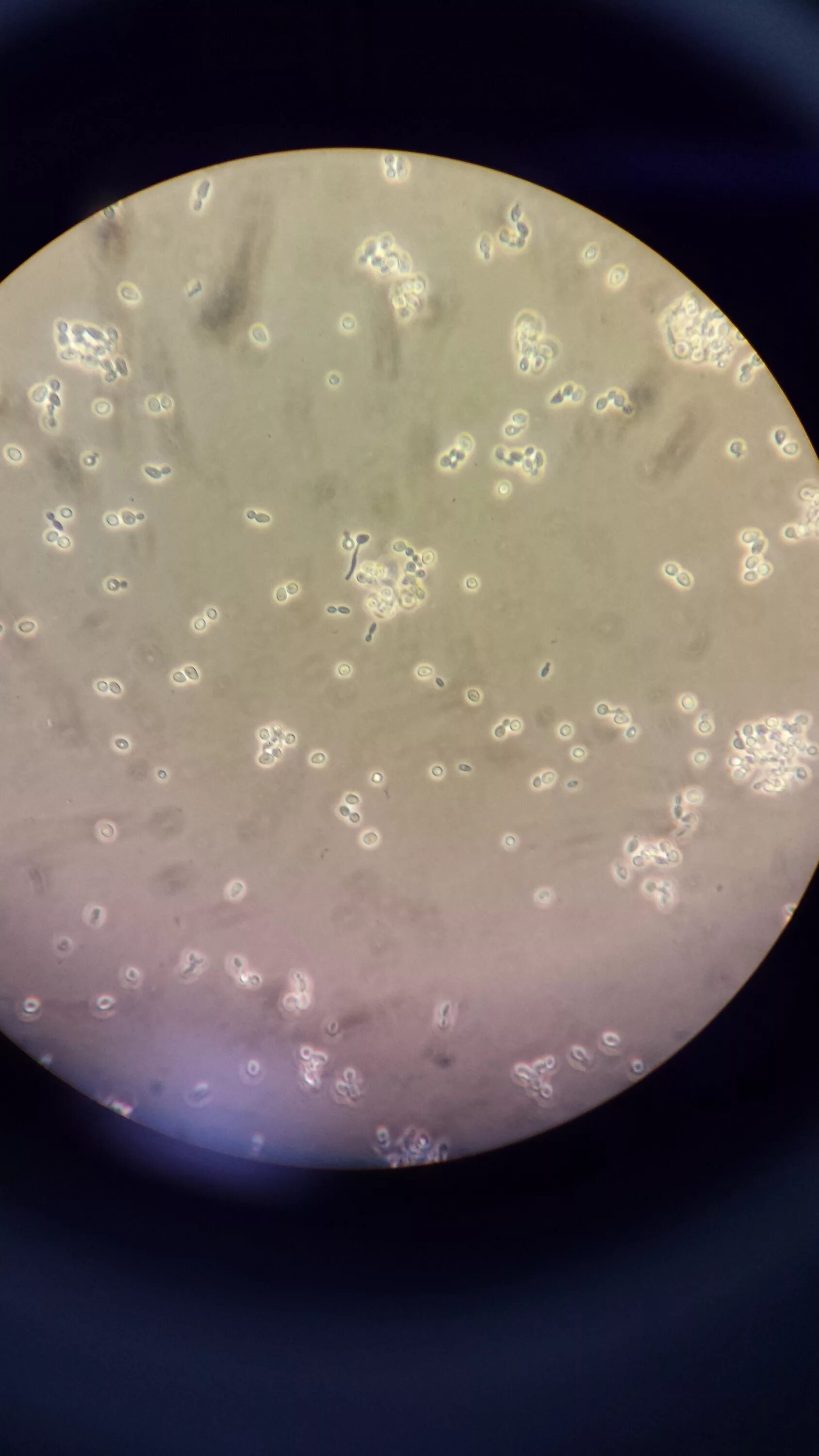 Candida Auris Infection: CDC Maps Show States With Most Cases - Business Insider