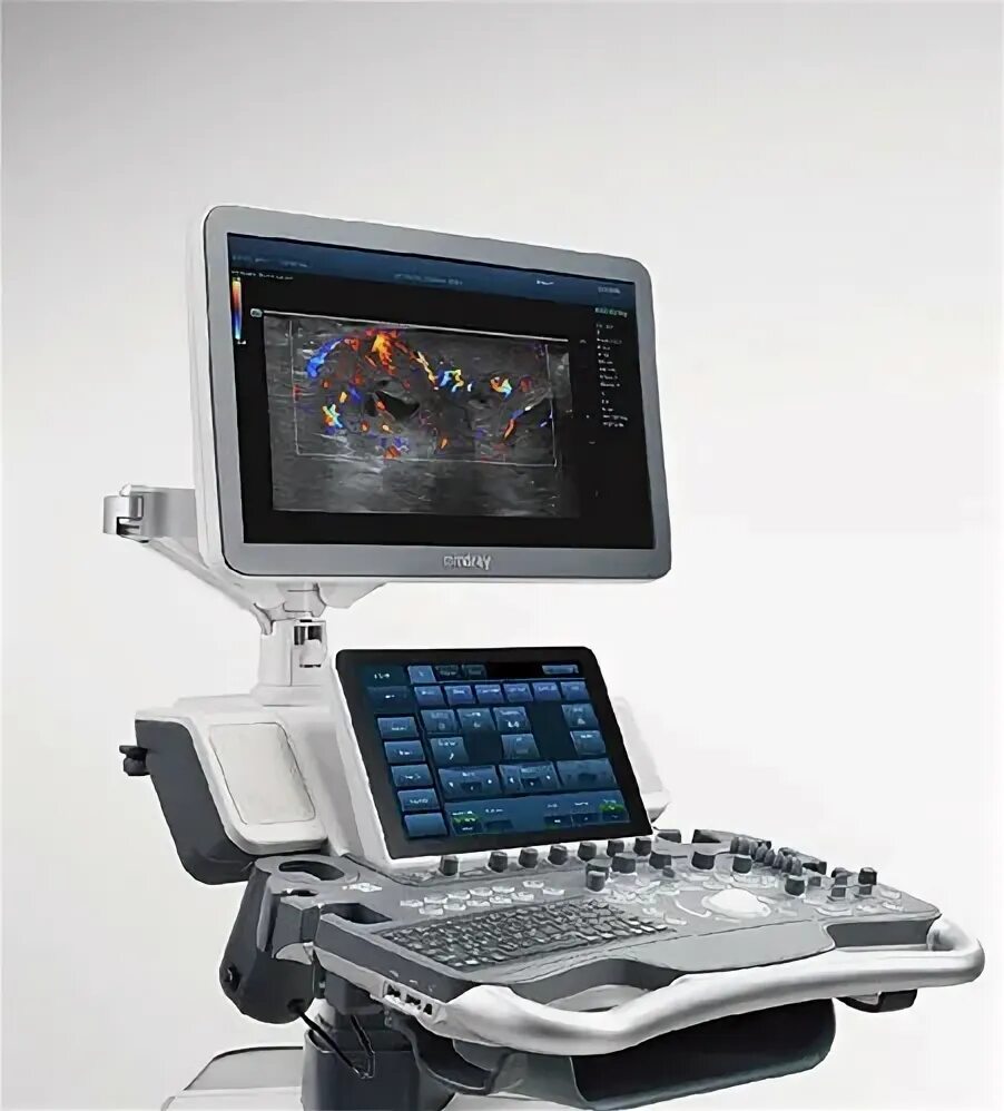 Mindray dc-60 x-insight. Игрушечный аппарат узи. Mindray dc 80 exp. Узи аппарат mindray dc-80. Mindray dc 80 x insight.