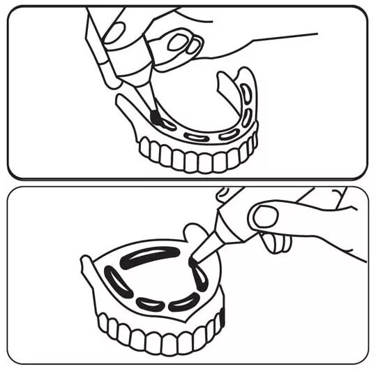 Как правильно наносить корегу на протез. Нанесение фиксирующего крема на зубной протез. Нанесение крема Корега на протез. Нанесение кореги на Нижний протез. Корега для зубных протезов.