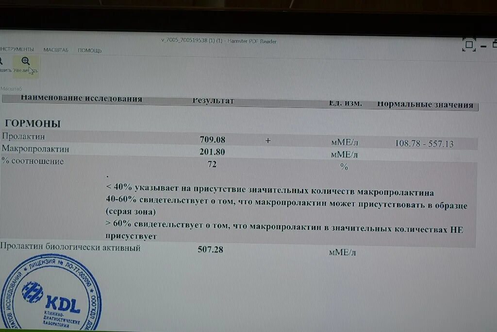 Что означают анализы пролактин. Мономерный пролактин анализ. Пролактин и макропролактин расшифровка анализа. Макропролактин биологически активный норма. Пролактин и макропролактин.