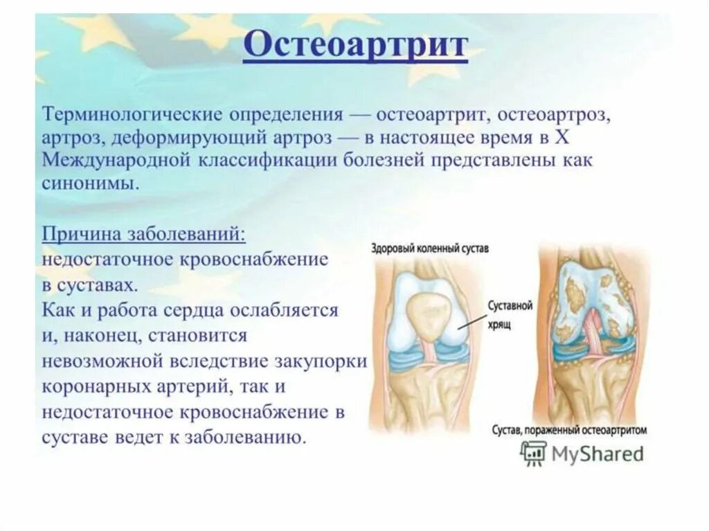 Болезни суставов температура. .Деформирующий остеоартрит остеоартроз. Поражение суставов при деформирующем остеоартрозе. Остеоартроз профилактика. Остеоартрит презентация.