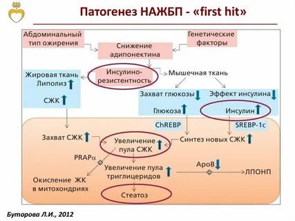 Неалкогольная болезнь