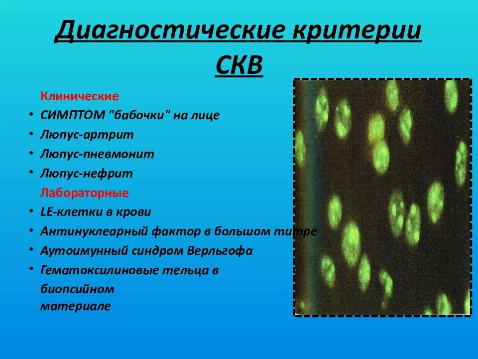 Смешанные заболевания соединительной. Клинические проявления системных заболеваний соединительной ткани. Этиология системных заболеваний соединительной ткани. Системные заболевания соединительной ткани классификация. Системные поражения соединительной ткани симптомы.