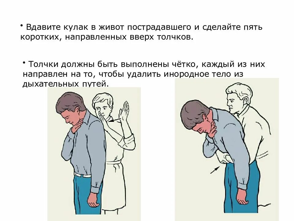 При закупорке дыхательных путей. Оказание помощи пострадавшему при обструкции дыхательных путей. Обструкция верхних дыхательных путей. Первая помощь при закупорке верхних дыхательных путей.