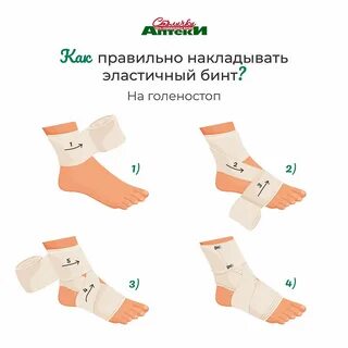 Нужно ли фиксировать