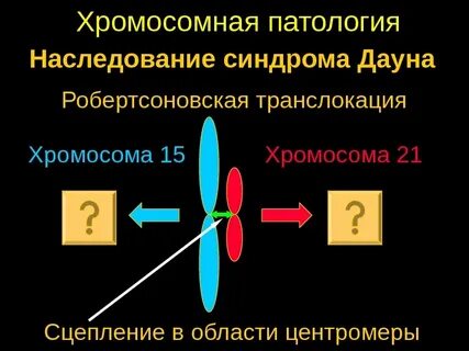 Транслокация 15 хромосомы на 15