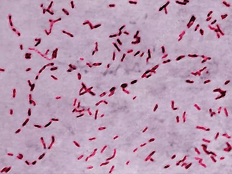 Anti bordetella pertussis положительный. Бактерия возбудитель коклюша. Бордетелла пертуссис. Бордетеллы коклюша. Бордетеллы коклюша микроскопия.