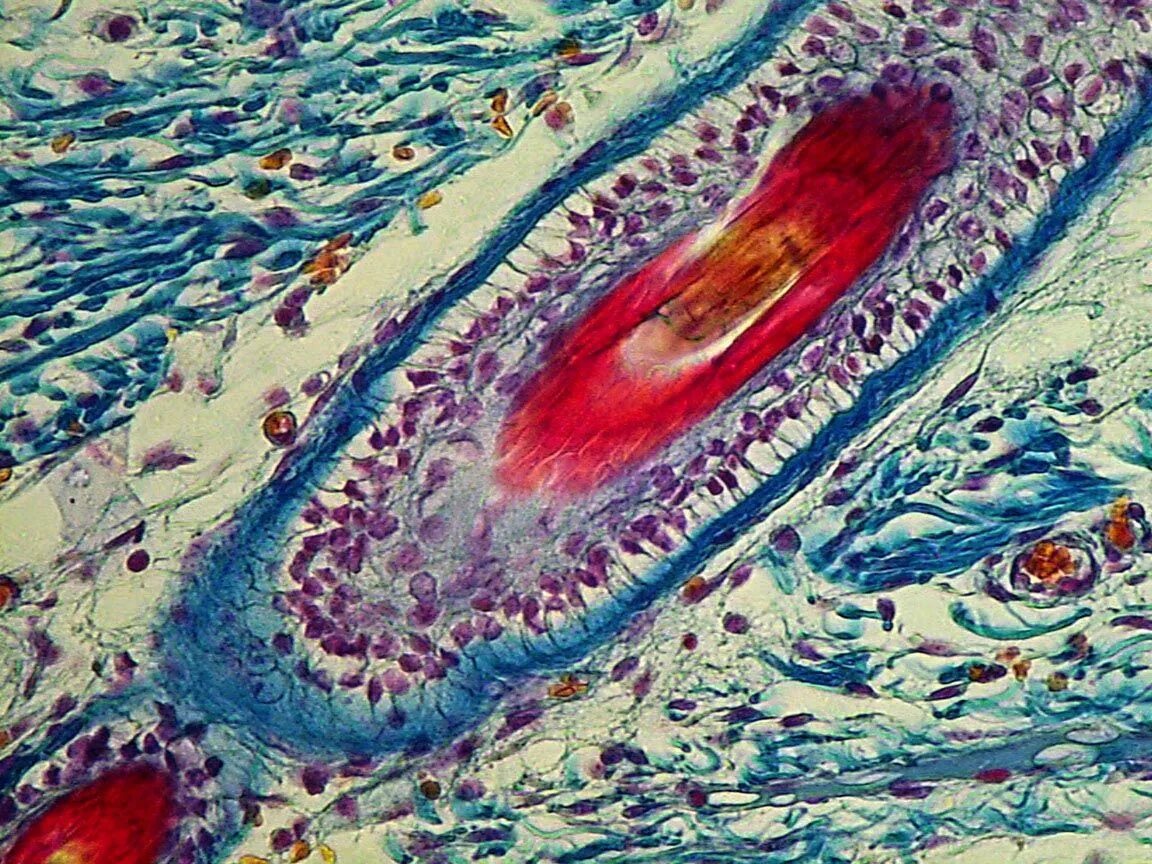 Гистологическое строение волосяного фолликула. Стволовые клетки волосяного фолликула. Фолликул под микроскопом. Стволовые клетки в фолликуле волоса.