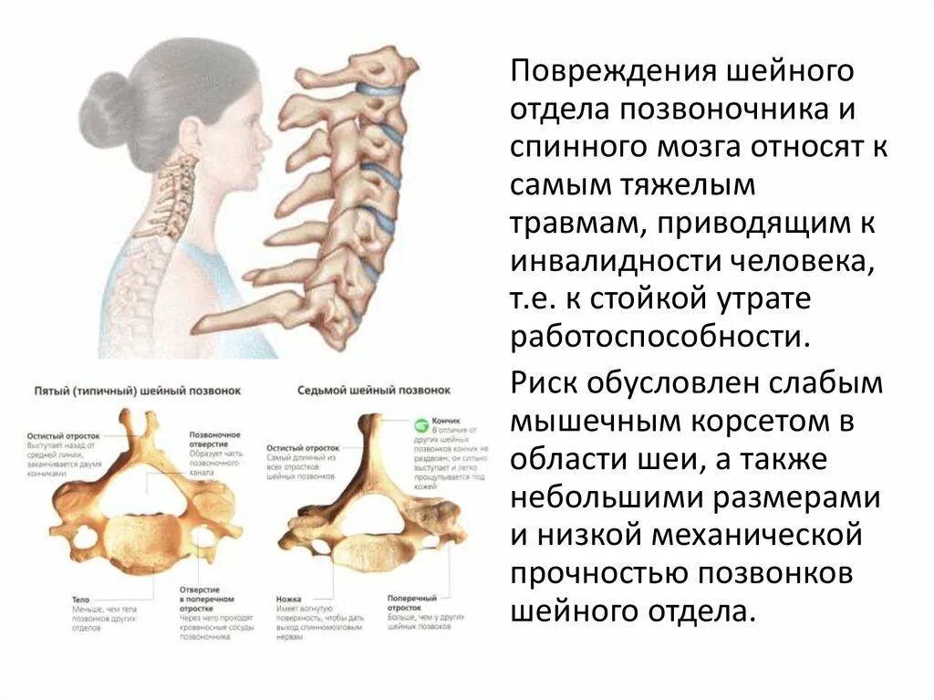 Характеристики позвонков шейного отдела. 7 Шейный позвонок. 7 Шейный позвонок шейного отдела. Позвоночник 7 шейный позвонок. 6 И 7 позвонки шейного отдела.