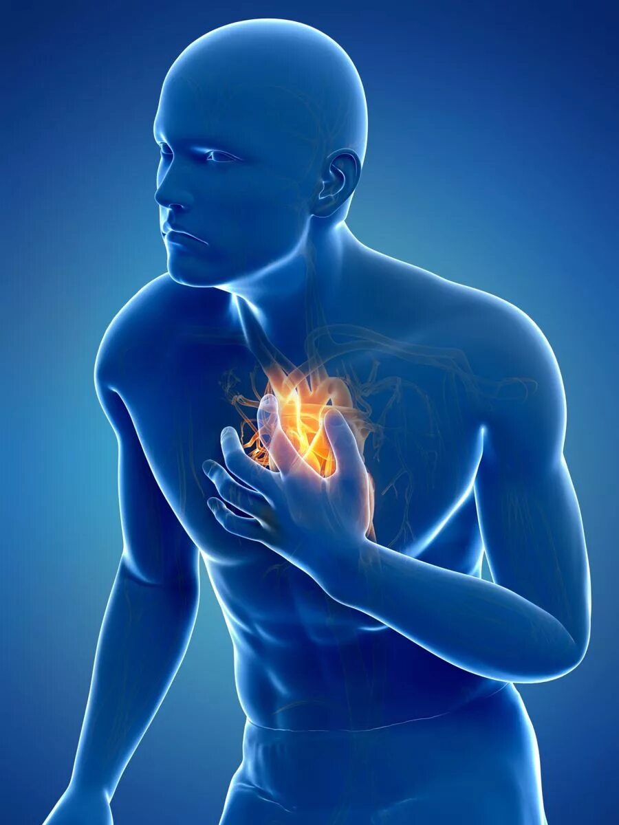 Heart attack speed up