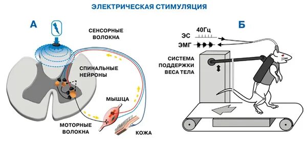 Как работает стимуляция. Электростимулятор спинного мозга. электрический стимулятор спинного мозга. электростимуляция спинномозговой. чрескожная электростимуляция спинного мозга.