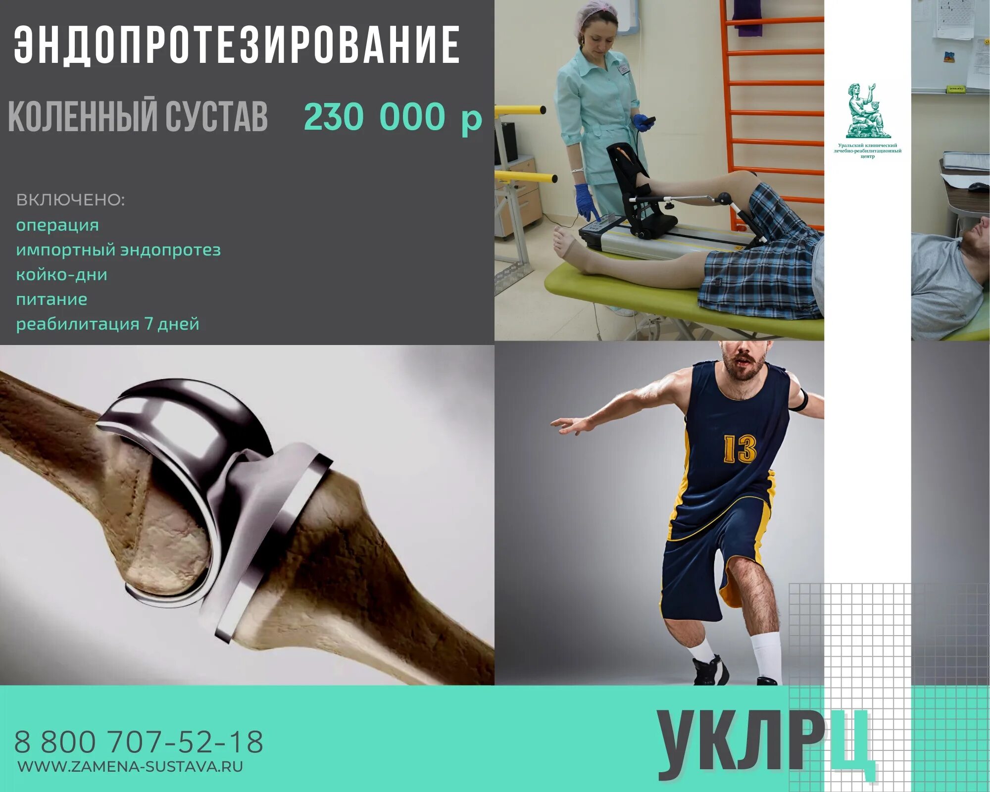 Операция по эндопротезированию отзывы. 230 суставов. эндопротезирование коленного сустава отзывы после операции.