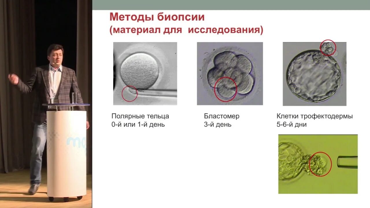 Что такое пгт при эко. Биопсия трофэктодермы. эко с пгд. трофэктодермы эмбриона.