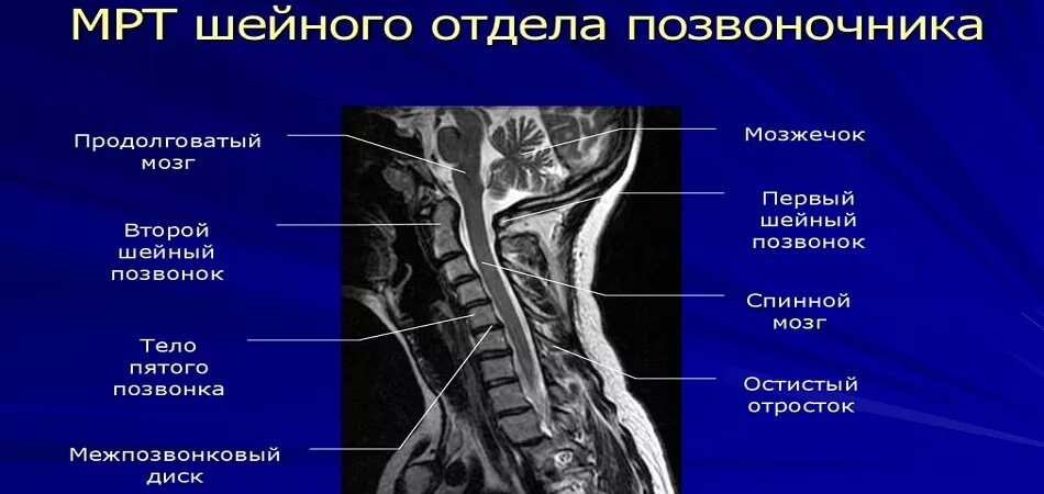 Функции шейного отдела. С7 позвонок анатомия. Позвоночник шейный отдел строение с4. Шейный отдел позвонка спинной позвоночник.