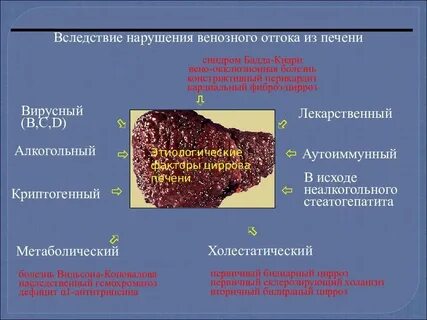 Состояние при циррозе