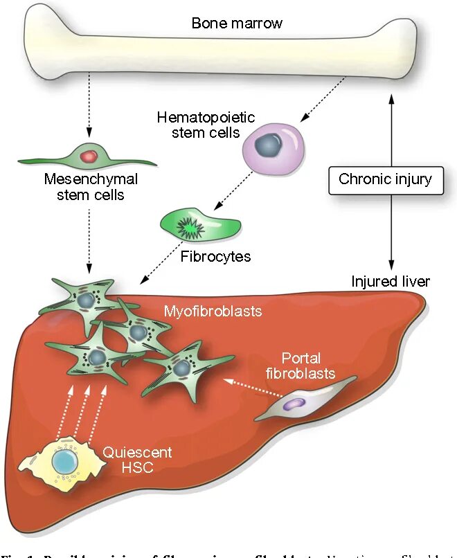 Стволовые клетки печени. Bone marrow Stem Cells. Mesenchymal Stem Cells. Мезенхимальные стволовые клетки. Трансплантация фибробластов.