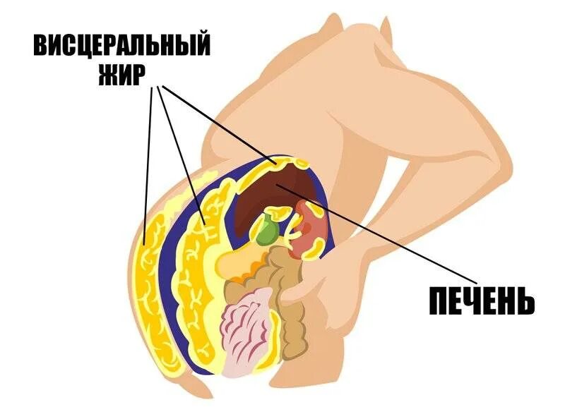 Висцеральный жир внутренних органов. Внутренний висцеральный жир. Ожирение внутренних органов.