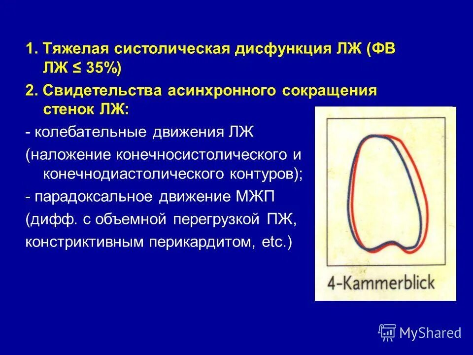 Систолическая дисфункция