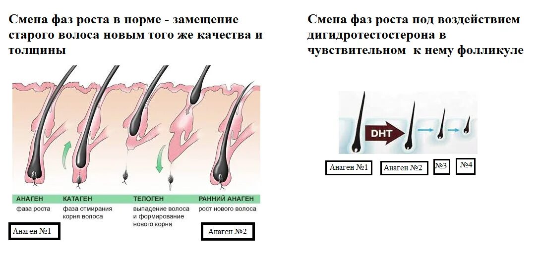 Сильный рост волос. Фазы роста волос электроэпиляция. 3 Фазы роста волос. Фазы роста волос анаген. Фазы роста волосяного фолликула.