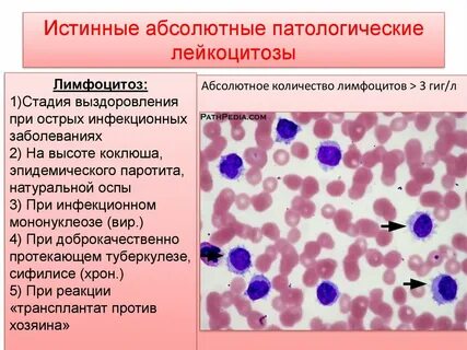 Снижение лимфоцитов при инфекции