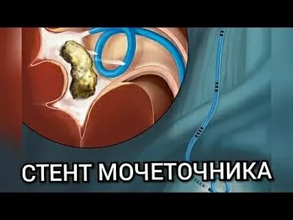 Почки нижний новгород