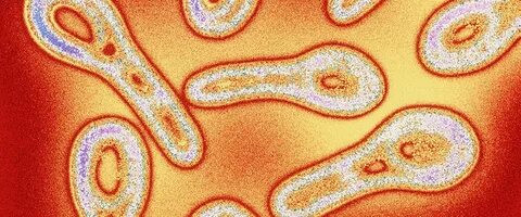 Дифтерия инфекционное