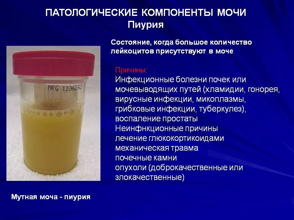 Мутная моча у женщины симптом какой