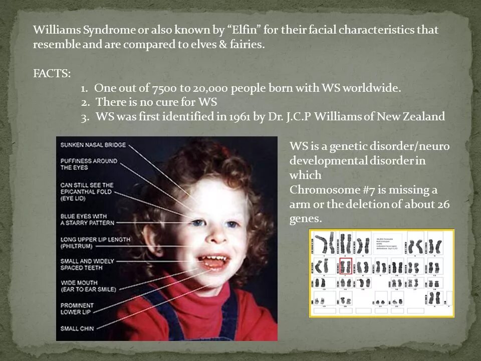 синдром уильямса что это