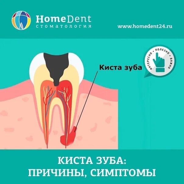 Свищ Зубов Фото - 93456439.ru