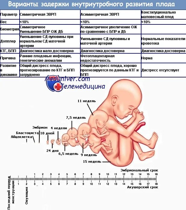 15 неделя сердцебиение. Синдром задержки развития плода диагностика. Внутриутробная задержка роста плода. Задержка внутриутробного развития плода степени. Внутриутробная задержка роста плода степени.