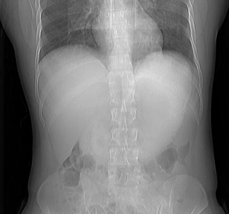 рентген брюшной полости. рентген дома. оборудование для рентгенкабинета. рентген сестрорецк. телерентгенограмма черепа (трг).