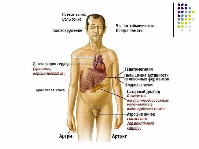 Синдром больной печени. Внешние проявления болезни печени. Признаки поражения печени у мужчины. Цирроз печени человек симптомы. Цирроз печени симптомы у мужчин.