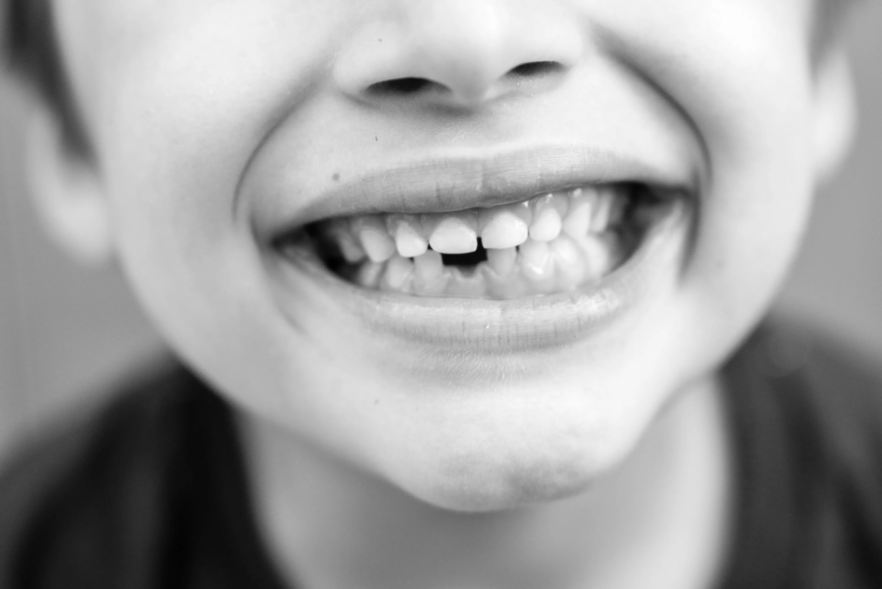 Молочные зубы картинки. Здоровые зубы у детей. Красивые зубы у детей. Красивые молочные зубы. Молочные зубы улыбка.