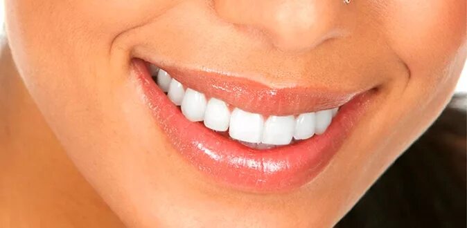 улыбка под 1. красивая улыбка зубы. улыбка ребенка. улыбка под 1. красивые зубы.