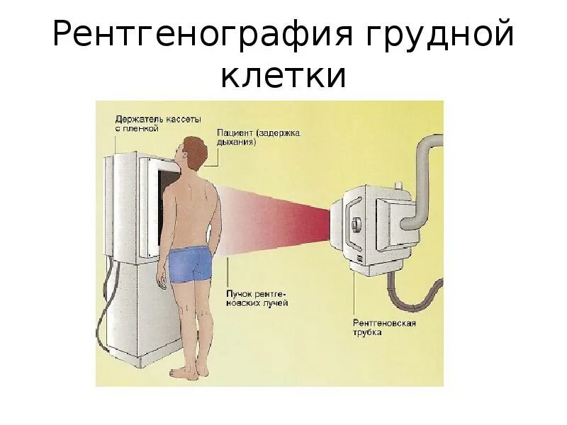 Рентген легких подготовка. Рентген легких подготовка. Подготовка больных к рентгенографии лёгких. Рентген легких подготовка. Рентген органов грудной клетки подготовка пациента.