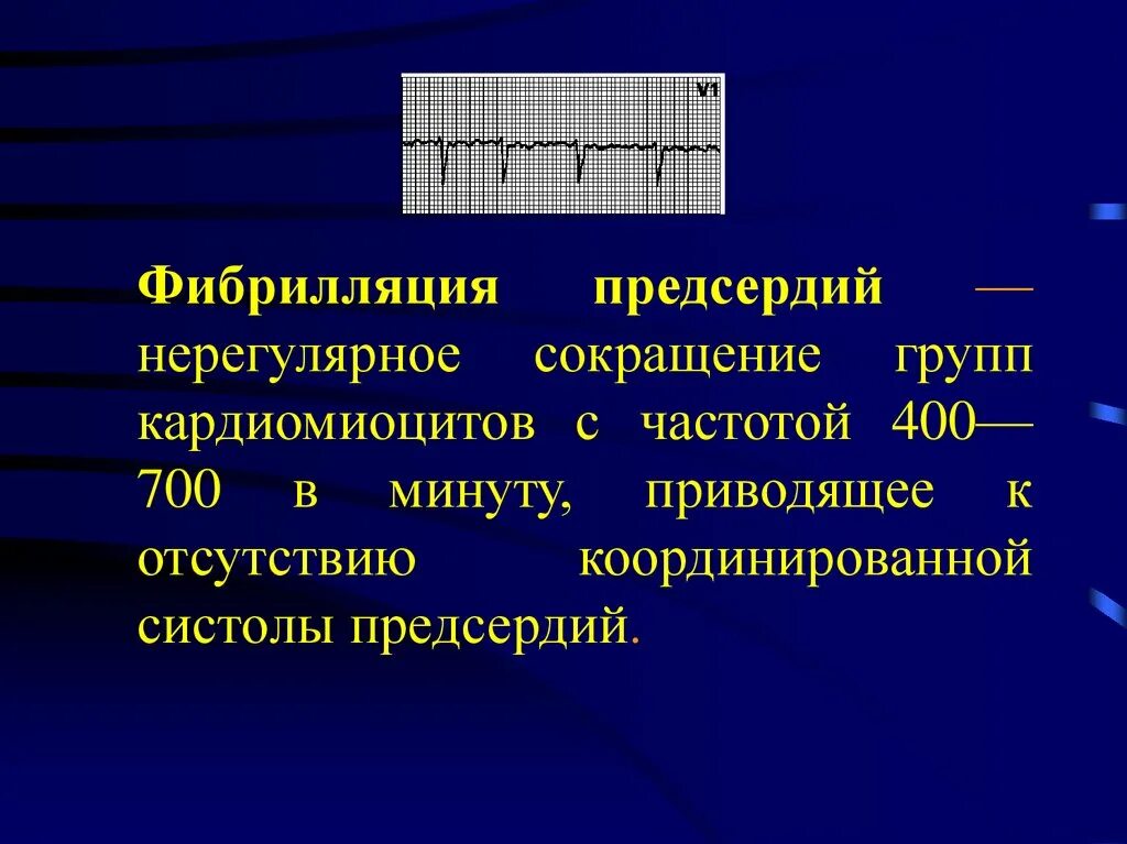 Клиника при фибрилляции предсердий. Ритмированная форма фибрилляции предсердий. Пароксизмальная фибрилляция предсердий на ЭКГ. Основные симптомы фибрилляции предсердий. Предсердие болезни