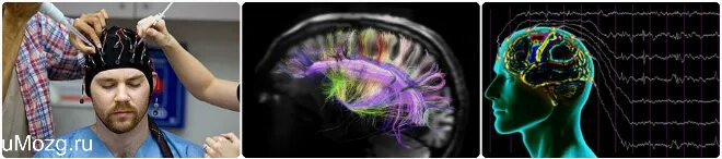 Ритмы головного мозга. Биоэлектрическая активность головного мозга. Биопотенциалы мозга. Диффузные изменения биотоков головного мозга.
