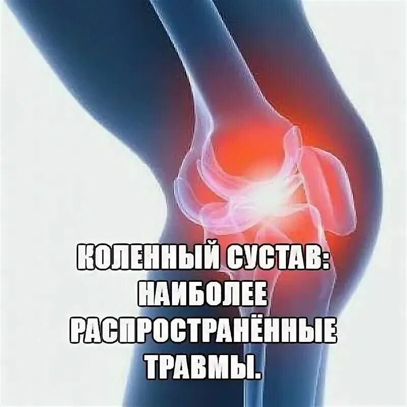 Распространенные травмы. Распространенные травмы колена. рассекающий остеохондрит коленного сустава. травма коленного сустава проволока.