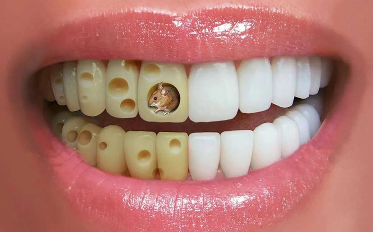 Курить после лечения зуба