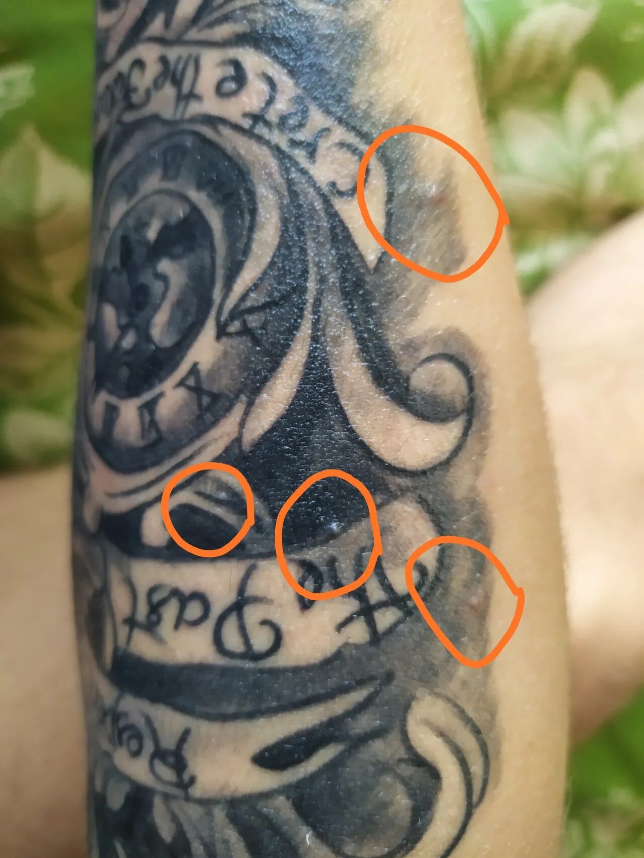 Татуировки на шрамах на родинках. Тату на прыщах можно ли. Созвездие лицо. Тату на прыщах можно ли. Тату на прыщах можно ли.