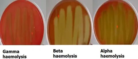 Объясните значение тэ и производящих основ haemolysis