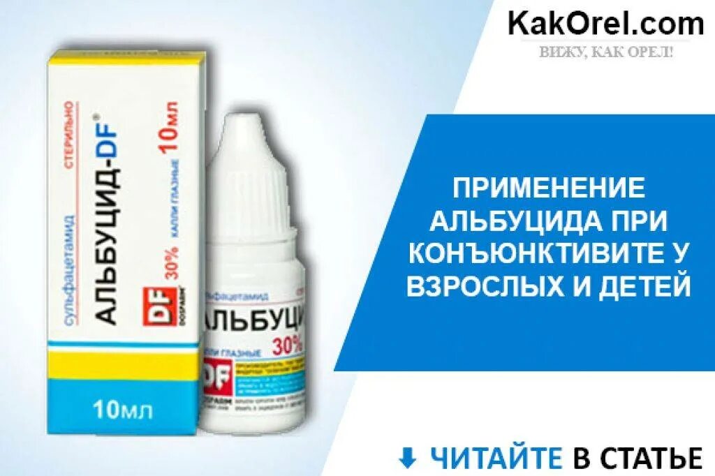 Препараты при конъюнктивите у взрослых. Глазные капли от конъюнктивита альбуцид. капли от конъюнктивита для детей альбуцид. альбуцид при конъюнктивите у детей. альбуцид глазные при конъюнктивите у взрослых.