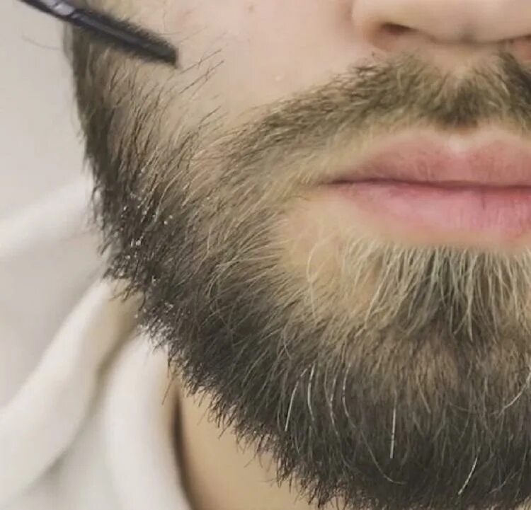 Какие волосы на бороде